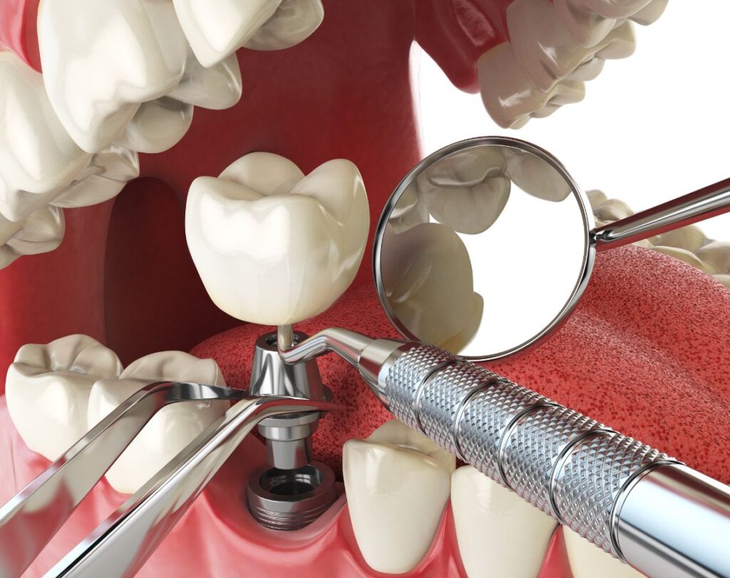 Khivsara Dental Clinic