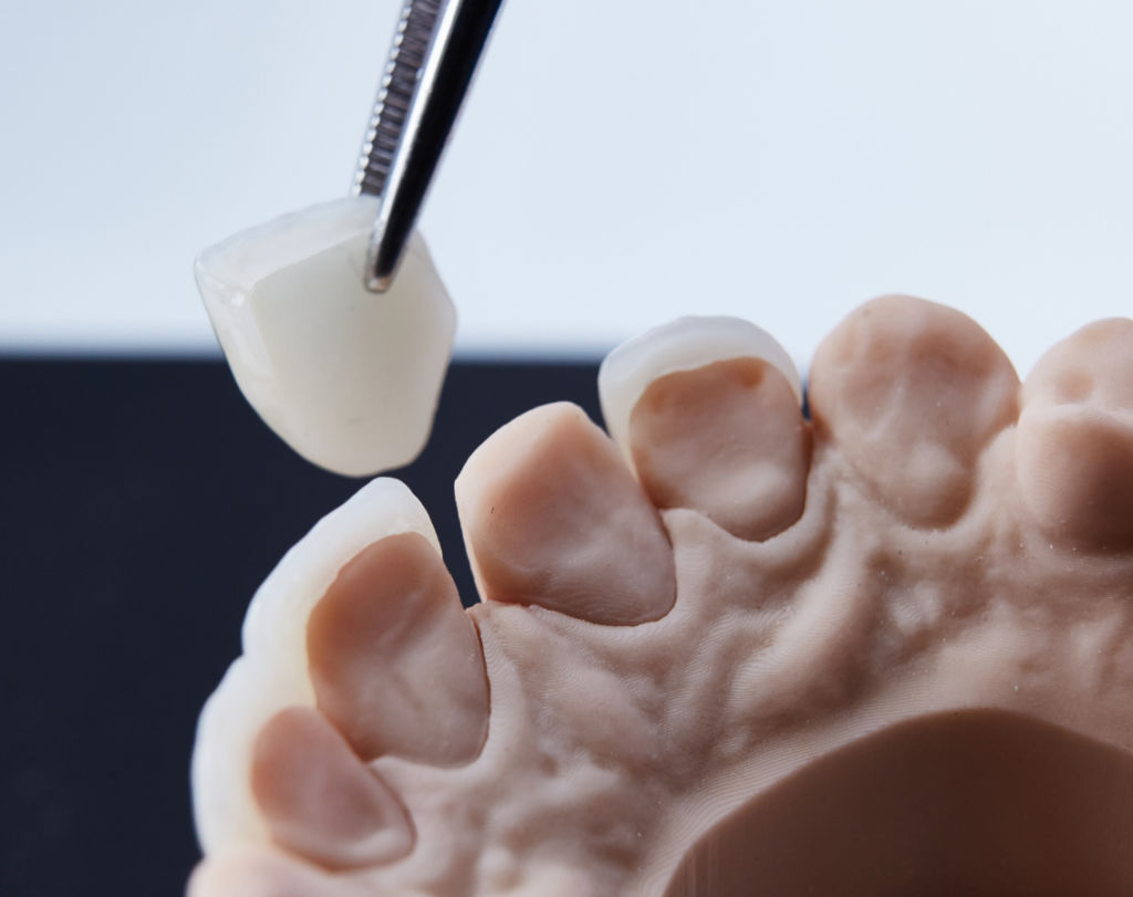 Khivsara Dental Clinic