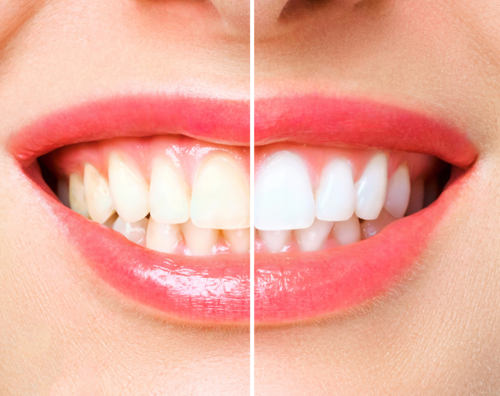 Khivsara Dental Clinic
