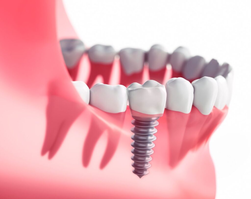 Khivsara Dental Clinic